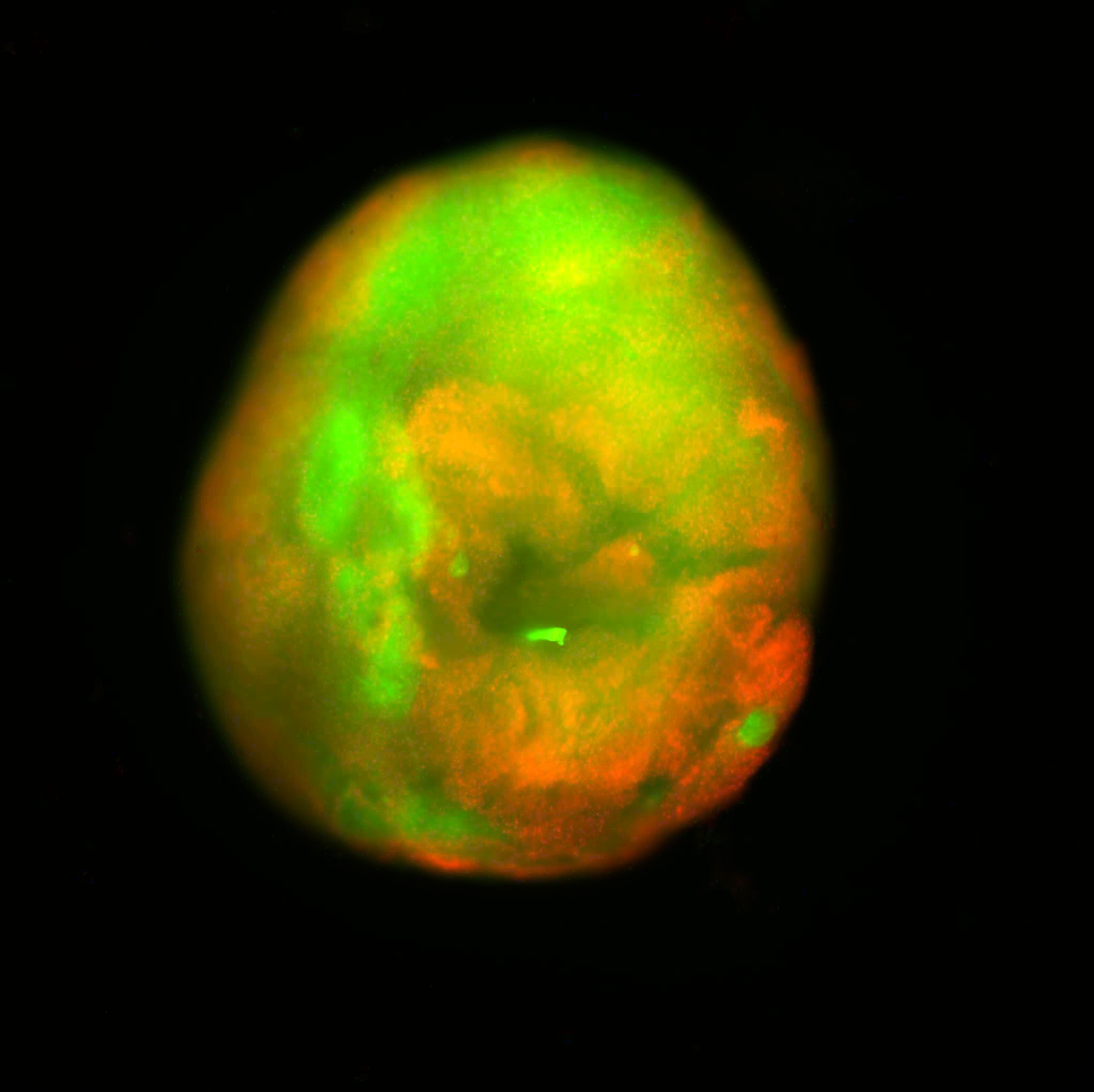 A fluorescent image of the human spinal cord organoid contusion model. Dead cells are red and live cells are green. A fluorescent image of the human spinal cord organoid contusion model. Dead cells are red and live cells are green.